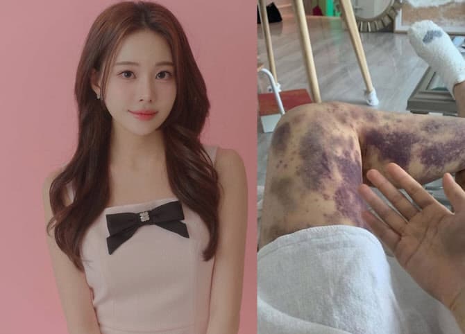 [아옳이] Model and Influencer Opens Up About Life After Divorce